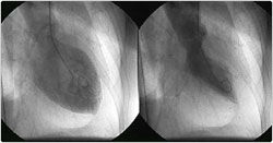 cardiologische something something